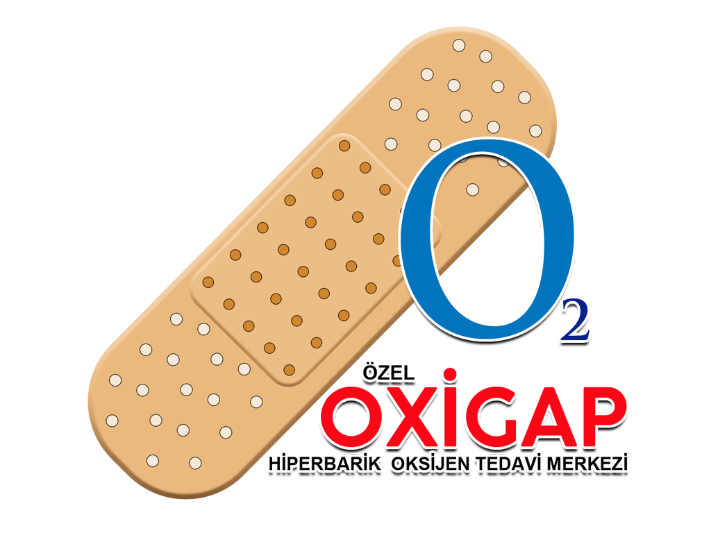 Oxigap Hiparbarik Oksijen Tedavi Merkezi